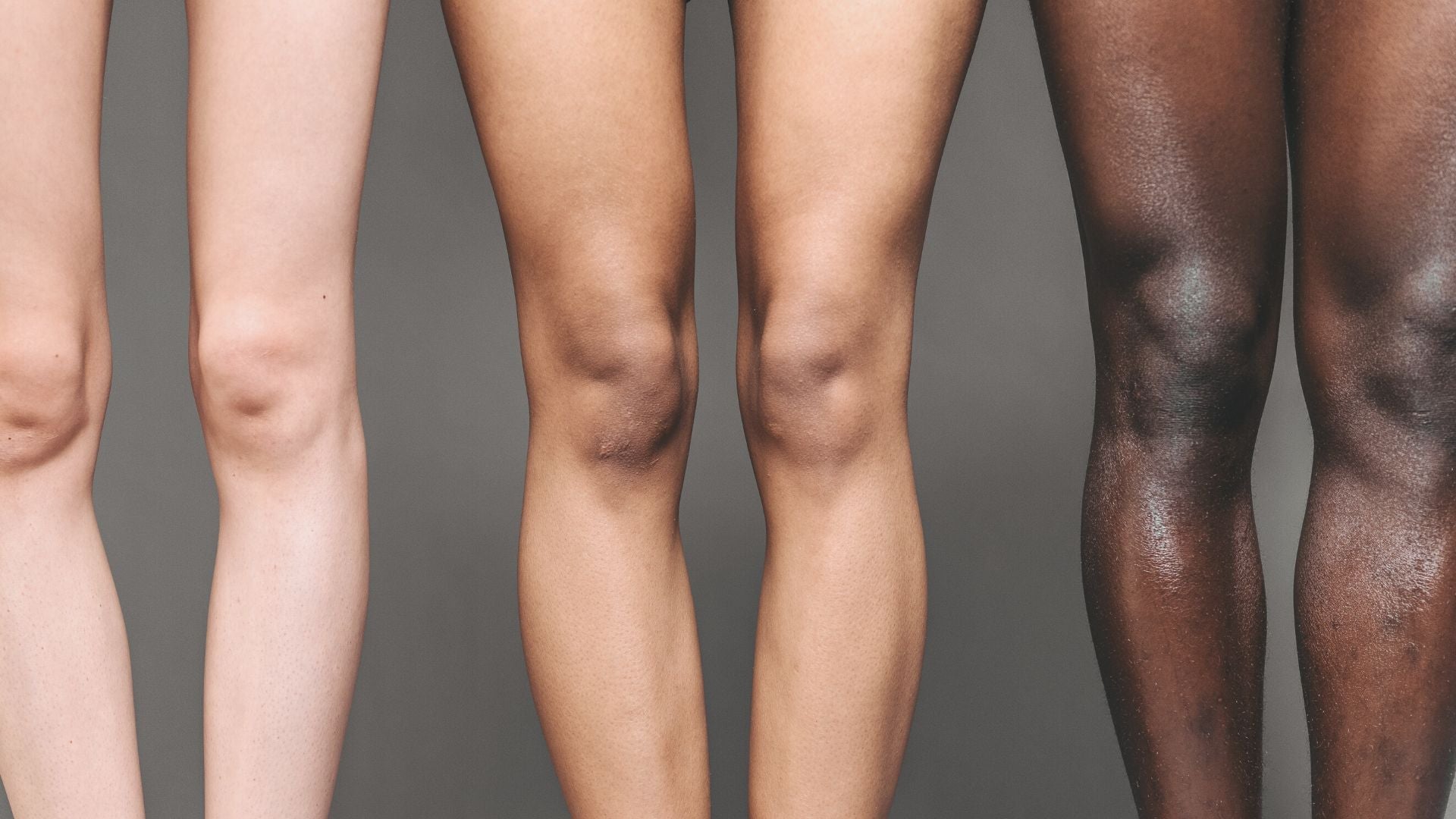 Three pairs of legs all with different skin types & colours