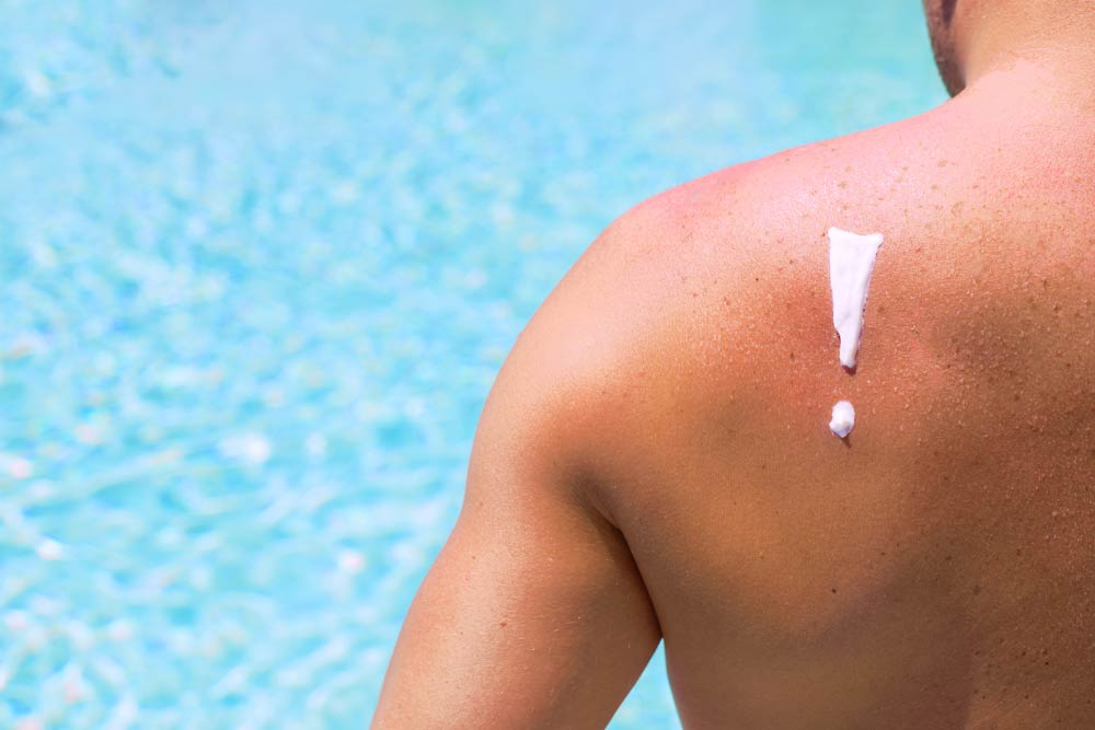How Long Does Sunscreen Last?